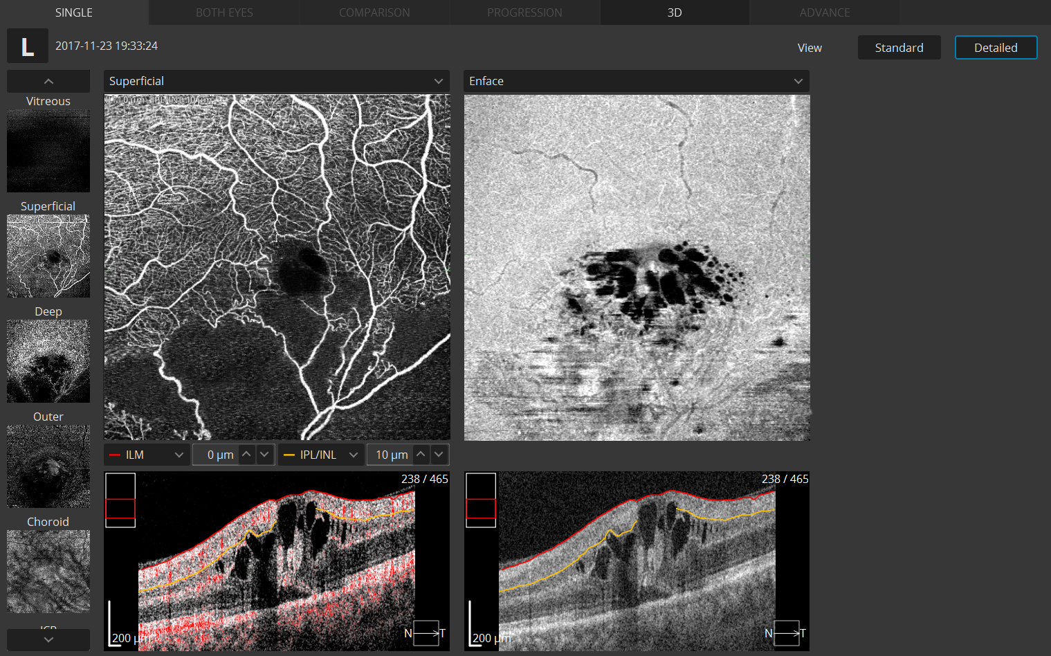 Revo Angio-Modul - Detail-Einzeldarstellung